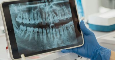 Dental Emergencies What to Do When Oral Health Takes a Sudden Turn (1)